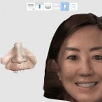 Intra-Oral Scan and Face Scan for Smile Analysis Image
